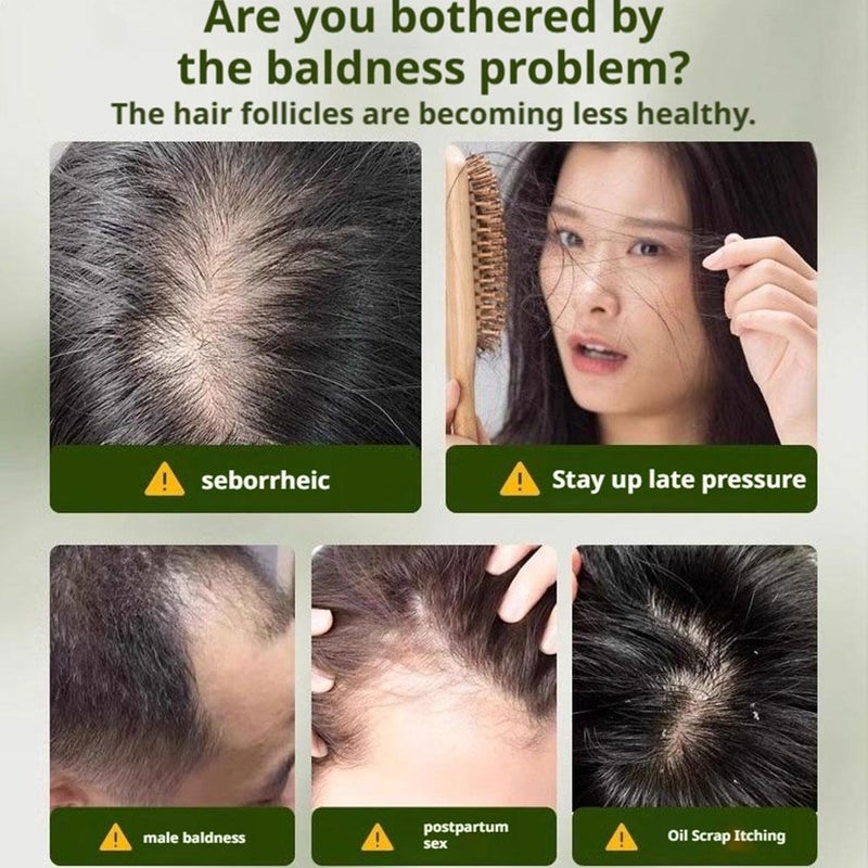 Natural Shampoo Bar for Women & Men – Solid Herbal Soap with Cypress, Fo-ti & Osmanthus Extracts, Sulfate-free Cleansing for All Hair Types (Style B) - Image 5